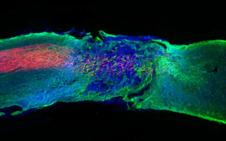 Dio kičmene moždine kod miša tretiran gelom, prikazuje regenerisana nervna vlakna u crvenoj boji (Foto: Samuel I. Stupp)
