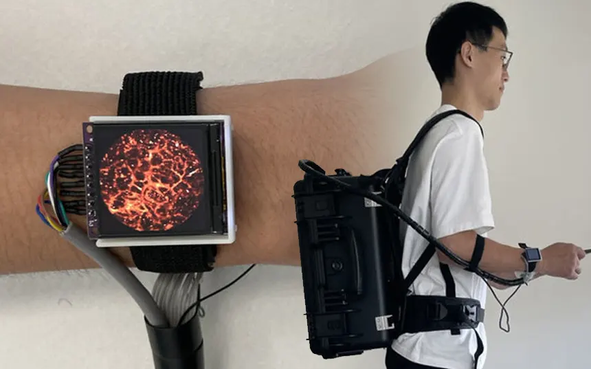 Fotoakustični sat za snimanje krvnih sudova u koži